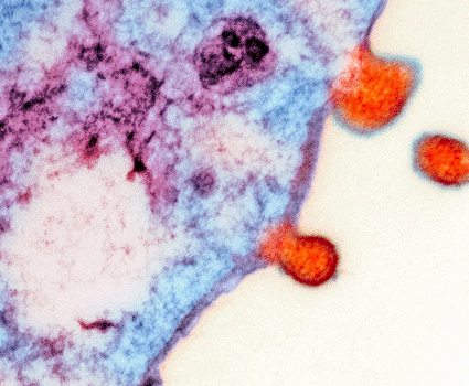 Image: Colored transmission electron micrograph (TEM) of a host cell with particles of the human metapneumovirus budding from its surface (Photo courtesy of Hazel Appleton, Center for Infections / Health Protection Agency).